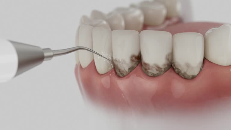 Trusted Invisalign Clear Aligners service in Oak Park, MI - Dentist Open Now